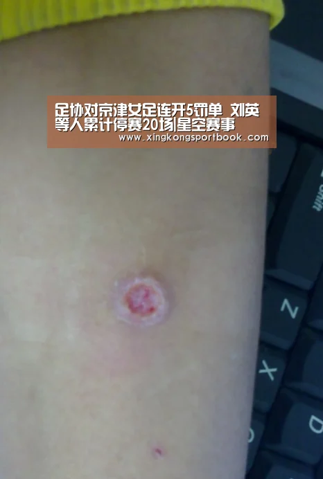 足协对京津女足连开5罚单 刘英等人累计停赛20场|星空赛事(图3) 星空下载